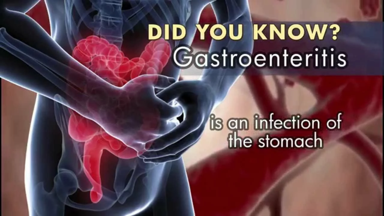 The Role of Calcium in Managing Atrophic Gastroenteritis